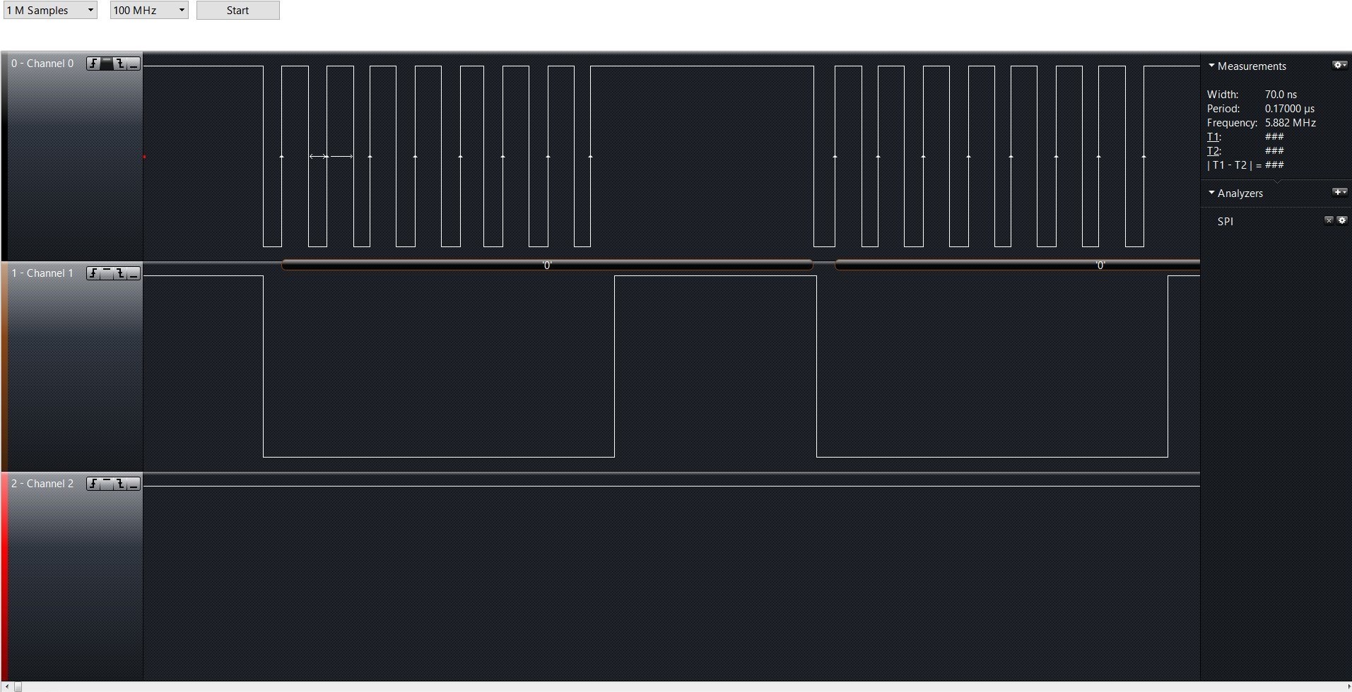 SPI_5M @24M.jpg